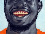 les dents de Adnan