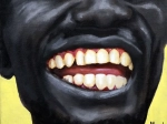 75 Dents de Malcolm