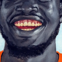 les dents de Adnan